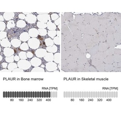 uPAR Antibody, Novus Biologicals:Antibodies:Primary Antibodies